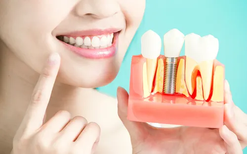 Patient consulting a dentist about signs they need dental implants at Dr. Sri Sushma Dental Clinic, Anandbagh Hyderabad