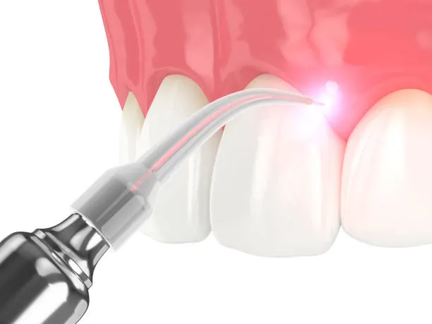 Gum Disease Treatment at Dr. Sri Sushma Multispeciality Dental Clinic, Anandbagh Hyderabad